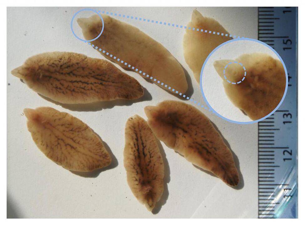 trematoda hepática