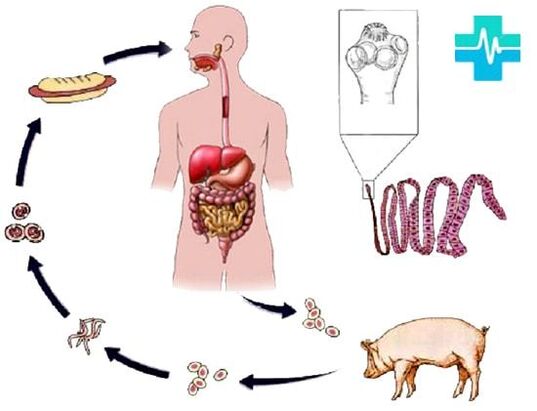Infección